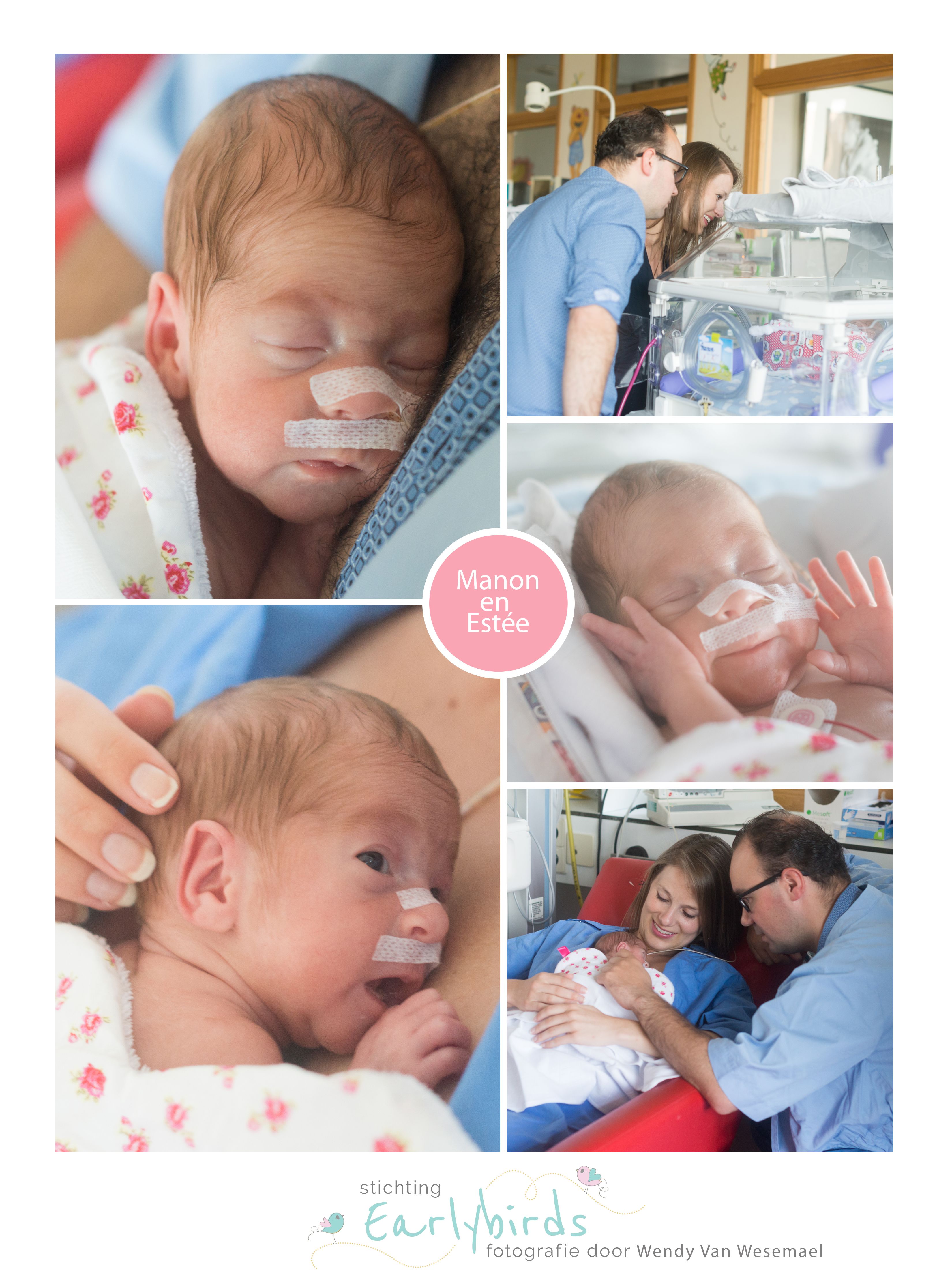 Manon en Estee prematuur 29 weken tweeling transfusie syndroom