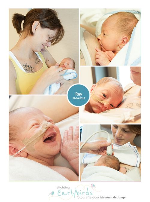 Rey prematuur 34 weken borstvoeding sondevoeding