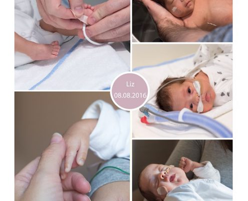 Liz prematuur geboren met 27 weken sondevoeding