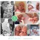 Dave & Luke prematuur geboren met 31 weken, weeenremmers, longrijping, ruggenprik, VUMC, Martini ziekenhuis