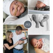 Jack, prematuur geboren met 31 weken en 5 dagen, bloedverlies, longrijping, weeenremmers, spoedkeizersnede, couveuse sondevoeding