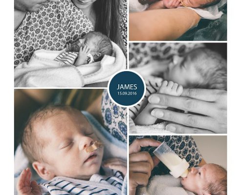 James prematuur, geboren met 32 weken, spoed