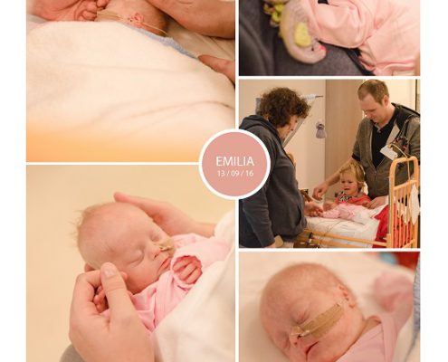 Emilia prematuur, geboren met 32 weken, HELLP syndroom, Down syndroom, spoedkeizersnede, buikvliesontsteking neonatologie