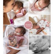 Jacelynn & Noahley, prematuur geboren met 27 weken, TTTS, CTG, spoedkeizersnede, NICU, vlinderzusje