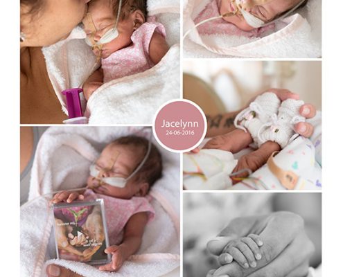 Jacelynn & Noahley, prematuur geboren met 27 weken, TTTS, CTG, spoedkeizersnede, NICU, vlinderzusje