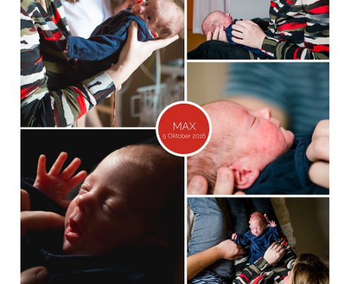 Max prematuur geboren met 29 weken en 3 dagen, bekken instabiliteit, pre-eclampsie HELLP syndroom