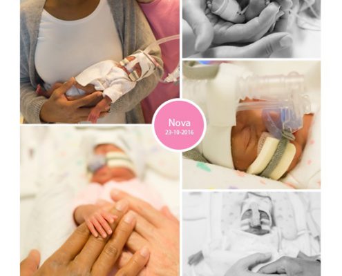 Nova prematuur geboren met 25 weken en 6 dagen, couveuse, IC, borstvoeding, sonde