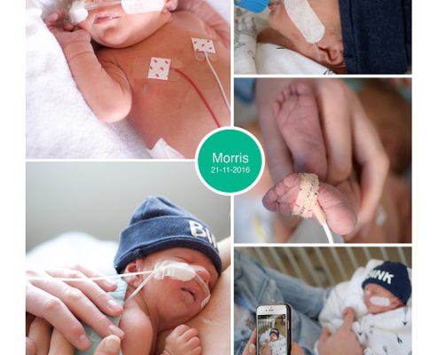 Morris prematuur geboren met 36 weken, WKZ