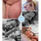 Siem prematuur geboren met 32 weken, Bernhoven