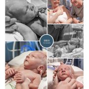 Mika prematuur geboren met 29 weken, VUMC, sonde