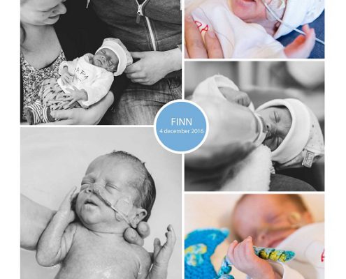 Finn prematuur geboren met 32 weken en 3 dagen, spoedkeizersnede, zwangerschapsvergiftiging, groei achterstand, St. Jansdal Harderwijk