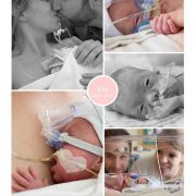 Ella prematuur geboren met 26 weken en 5 dagen, NICU, WKZ Utrecht, BiPAP, longinfectie, beademing, CPAP