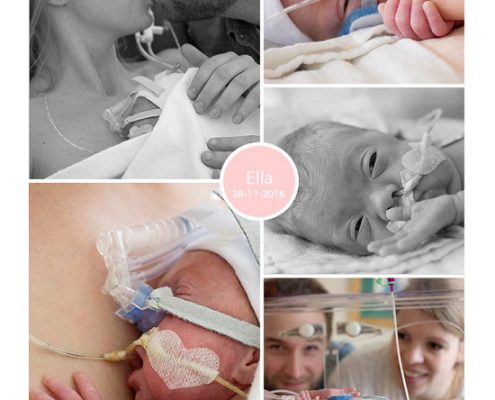Ella prematuur geboren met 26 weken en 5 dagen, NICU, WKZ Utrecht, BiPAP, longinfectie, beademing, CPAP