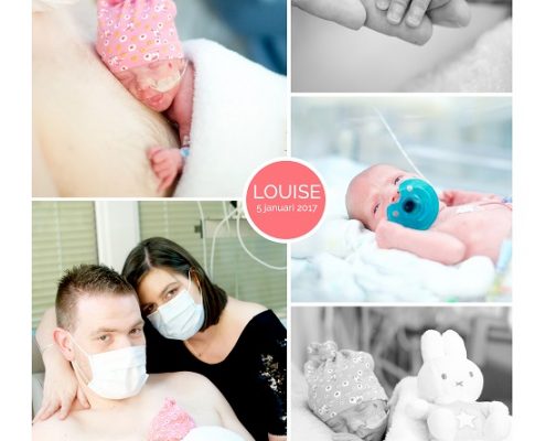 Louise prematuur geboren met 30 weken en 2 dagen, zwangerschapsvergiftiging, placenta
