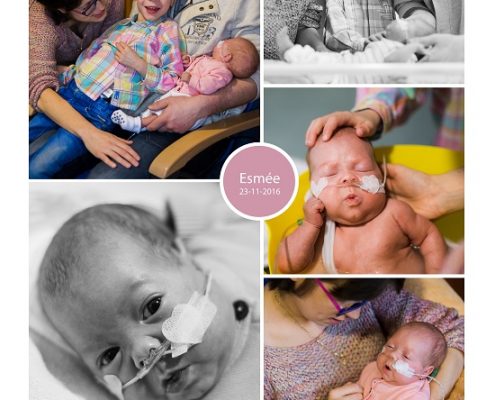 Esmée prematuur geboren met 29 weken, pre-eclampsie, CPAP, liesbreuk