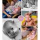 Esmée prematuur geboren met 29 weken, pre-eclampsie, CPAP, liesbreuk