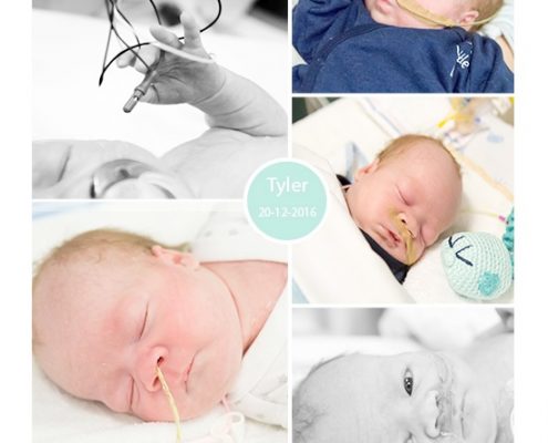 Tyler prematuur geboren met 35 weken, keizersnede, gastroschisis, couveuse, sondevoeding
