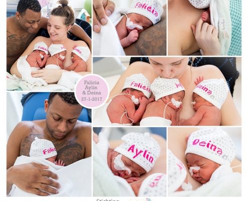 Deina, Aylin & Falicia prematuur geboren met 31 weken en 4 dagen, drieling, spoedkeizersnede, WKZ, zwangerschapsvergiftiging, HELLP syndroom
