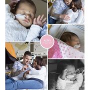Alina prematuur geboren met 34 weken en 3 dagen, ICSI, Jeroen Bosch ziekenhuis, eiwitten, zwangerschapsvergiftiging, keizersnede, couveuse