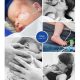 Boaz prematuur geboren met 33 weken, Sophia Kinderziekenhuis, spoedkeizersnede, ic-neonatologie