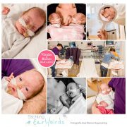 Vlinder & Bloem prematuur geboren met 26 weken en 2 dagen, tweeling, LUMC