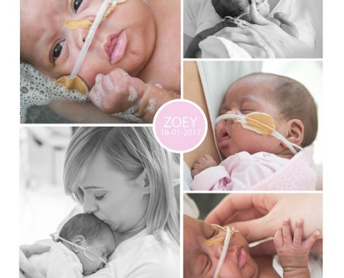 Zoey prematuur geboren met 25 weken en 6 dagen, Isala Zwolle, borstvoeding, zwangerschapsvergiftiging, CTG, spoedkeizersnede, CPAP