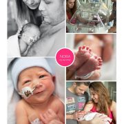 Nora prematuur geboren met 33 weken en 5 dagen, zwangerschapsvergiftiging, keizersnede