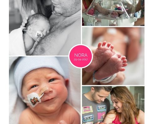 Nora prematuur geboren met 33 weken en 5 dagen, zwangerschapsvergiftiging, keizersnede