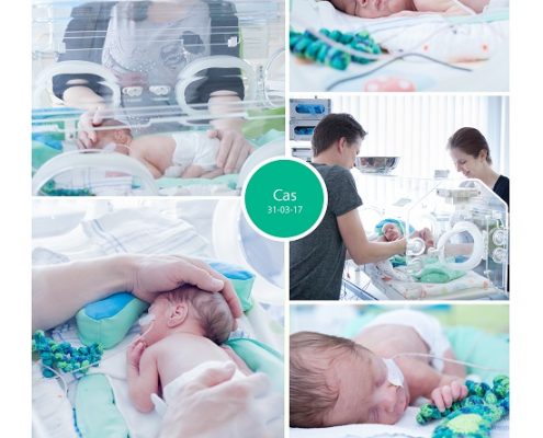 Cas prematuur geboren met 29 weken en 3 dagen, zwangerschapsvergiftiging, Antonius ziekenhuis