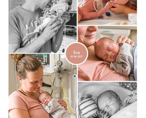 Eva prematuur geboren met 32 weken, PE-HELLP syndroom, couveuse