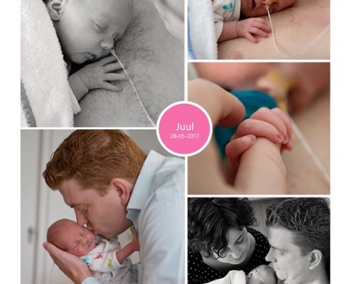 Juul prematuur geboren met 33 weken en 4 dagen, CWZ Nijmegen, Radboud Nijmegen, HELLP syndroom, borstvoeding, sondevoeding