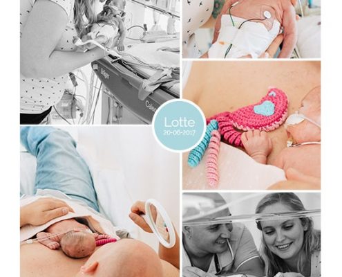 Lotte prematuur geboren met 27 weken, hoge bloeddruk, spoedkeizersnede, zwangerschapsvergiftiging, hersenbloeding, LUMC