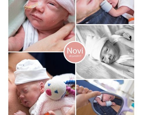 Novi prematuur geboren met 32 weken, couveuse