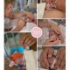Rosalie prematuur geboren met 29 weken en 3 dagen, HELLP syndroom, keizersnede, open ductus, WKZ