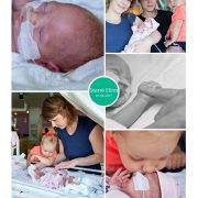 Sterrè Elinn prematuur geboren met 26 weken en 5 dagen, MCL, keizersnede, sondevoeding