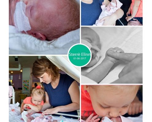 Sterrè Elinn prematuur geboren met 26 weken en 5 dagen, MCL, keizersnede, sondevoeding