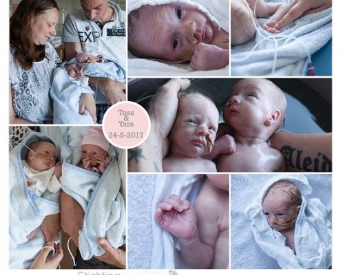 Tess & Yara prematuur geboren met 31 weken en 4 dagen, Bethesda ziekenhuis, tweeling, TTS