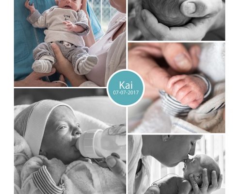 Kai prematuur geboren met 34 weken en 1 dag, Slingeland, hoge bloeddruk, CTG, pre eclampsie, keizersnede, couveuse