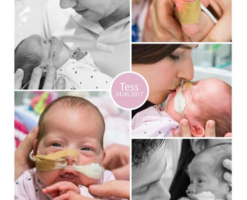 Tess prematuur geboren 30 weken slokdarm afwijking operatie