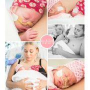 Liv & Zoe prematuur geboren 25 weken tweeling