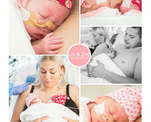 Liv & Zoe prematuur geboren 25 weken tweeling