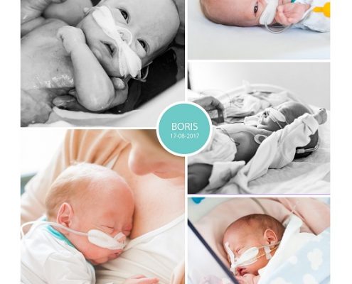 Boris prematuur geboren met 27 weken, gebroken vliezen, spoedkeizersnede, neonatologie