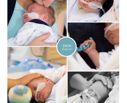 Dion prematuur geboren met 28 weken