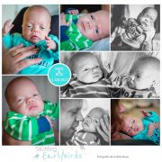 Max & Rox prematuur geboren met 28 weken en 2 dagen, tweeling, TTS, groeiachterstand, LUMC