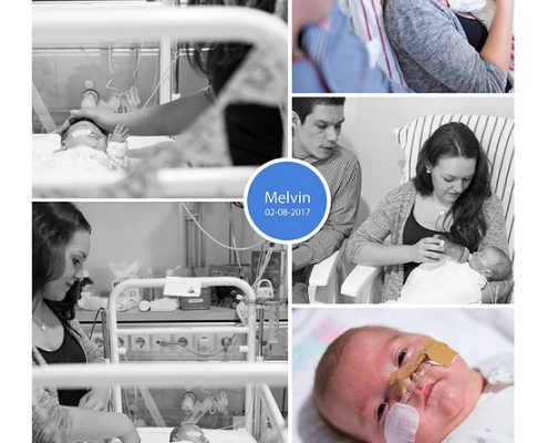 Melvin prematuur geboren met 27 weken, OZG Winschoten, zwangerschapsvergiftiging