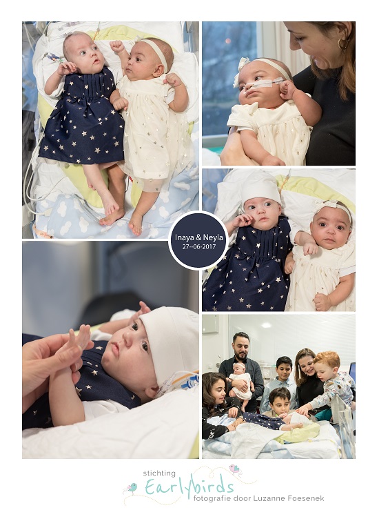 Inaya & Neyla prematuur geboren met 27 weken en 4 dagen, tweeling, UZA Antwerpen, gebroken vliezen, spoedkeizersnede