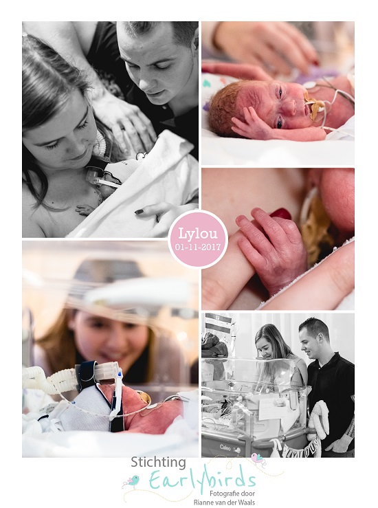 Lylou prematuur geboren met 25 weken, Radboud UMC