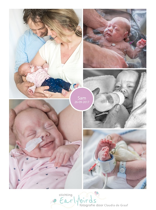 Sam prematuur geboren met 28 weken en 1 dag, HELPP syndroom, RUMC Nijmegen, keizersnede, neonatologie