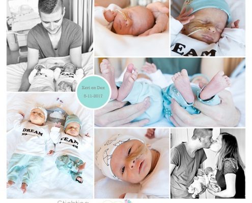 Xavi & Dex prematuur geboren met 33 weken en 6 dagen, tweeling, Bethesda ziekenhuis, PCOS, UMCG, blaasextrophie, gebroken vliezen, longrijping, weeenremmers