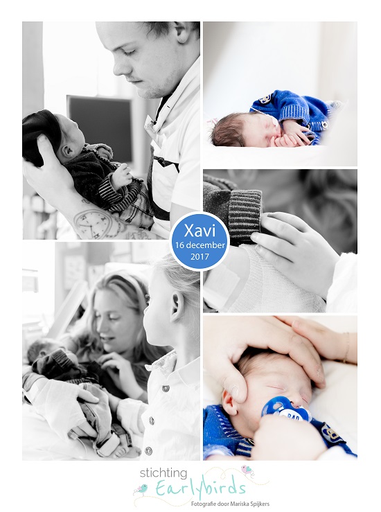Xavi prematuur geboren met 34 weken en 2 dagen, keizersnede, vluchkoffertje, couveuse, hartmonitor